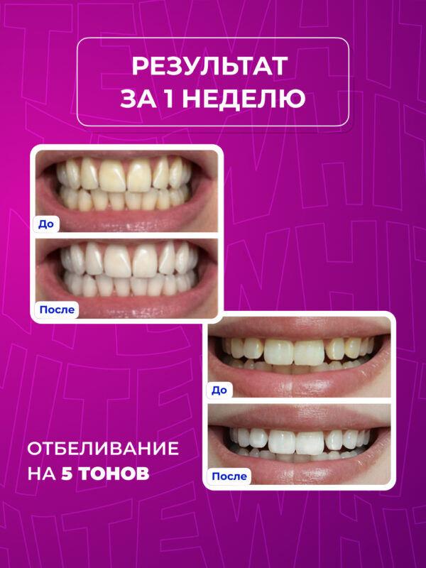 Полоски для отбеливания зубов 1 Саше Global White teeth whitening strips — изображение 3